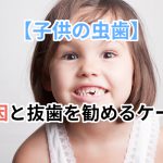 原因と抜歯を勧めるケース