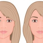 顔の歪みは矯正歯科で治せる！かみ合わせや顎関節症の治療で改善