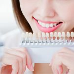 ホワイトニングによる弊害とは？施術前に知っておきたい5つの注意点