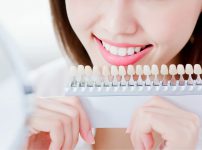 ホワイトニングによる弊害とは？施術前に知っておきたい5つの注意点