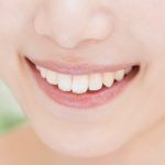 前歯のみを矯正したい！その方法と注意点を紹介